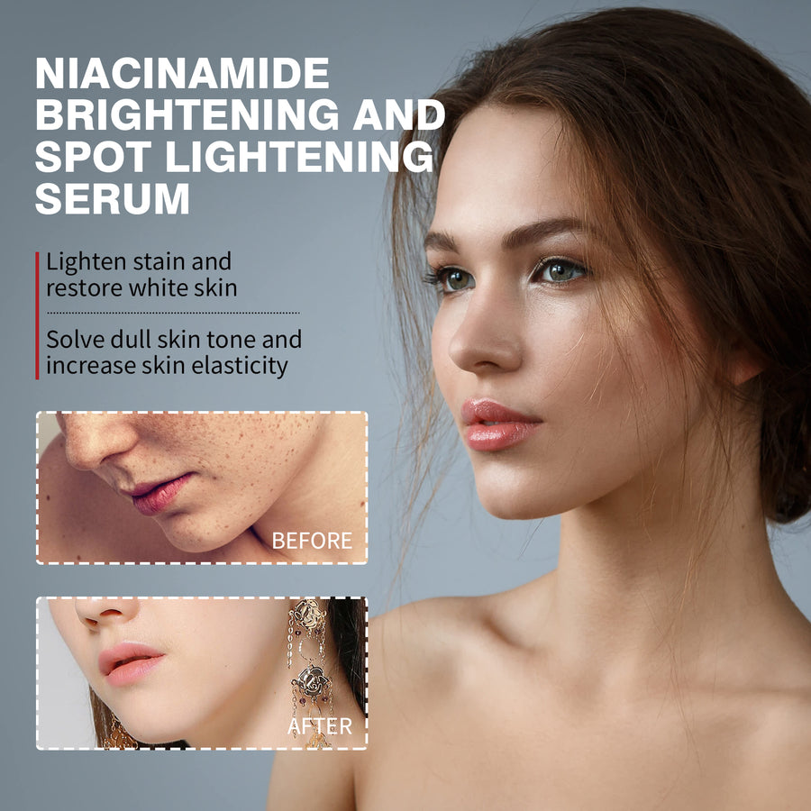 Niacinamide Brightening Serum for Dark Spots