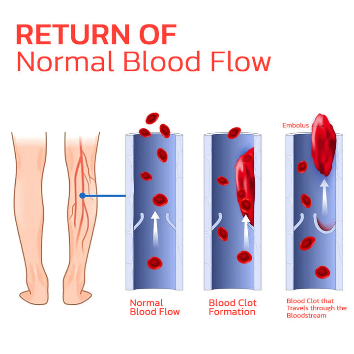 Acupressure Insoles for Arch Support and Foot Comfort