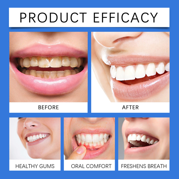Propolis Oral Spray for Fresh Breath & Cleaner Teeth