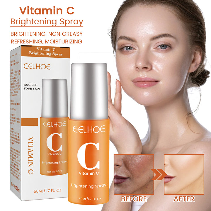Vitamin C Hydrating Face Mist – Fade Acne Spots & Brighten