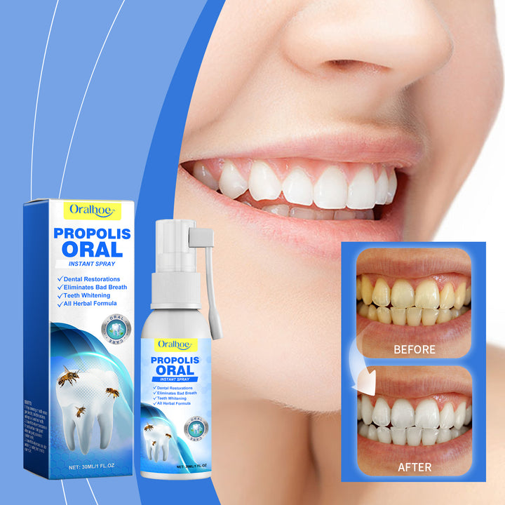 Propolis Oral Spray for Fresh Breath & Cleaner Teeth