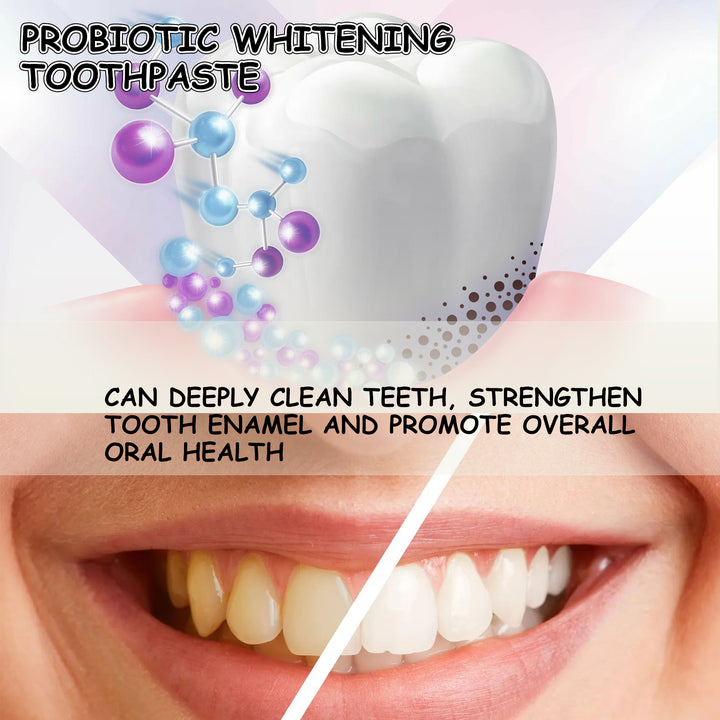 Probiotic Whitening Toothpaste for a Brighter Smile