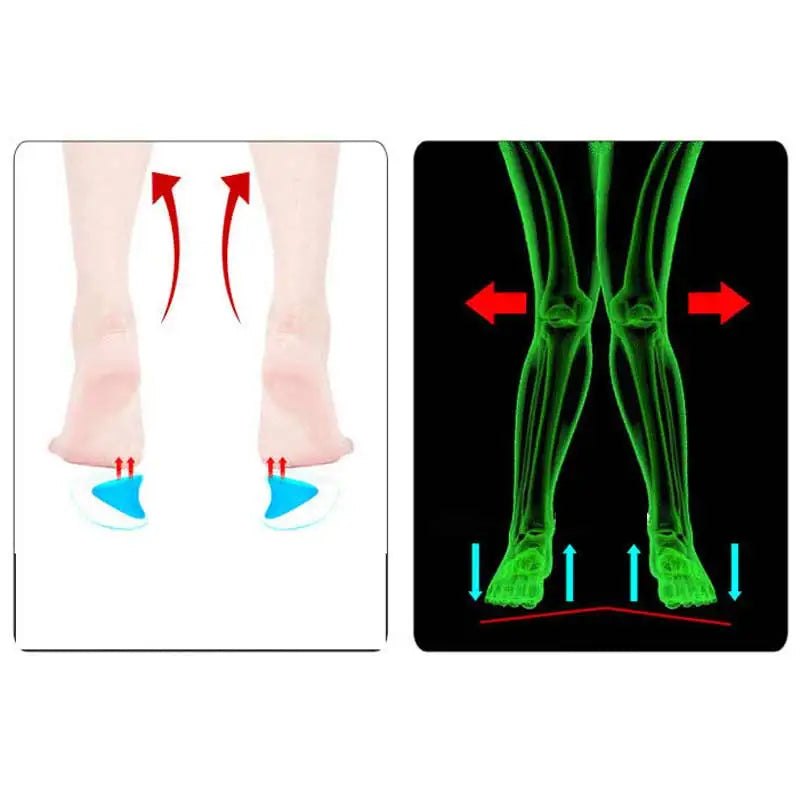 Arch Support Insoles for Flat Feet — Gel Pads with Massage