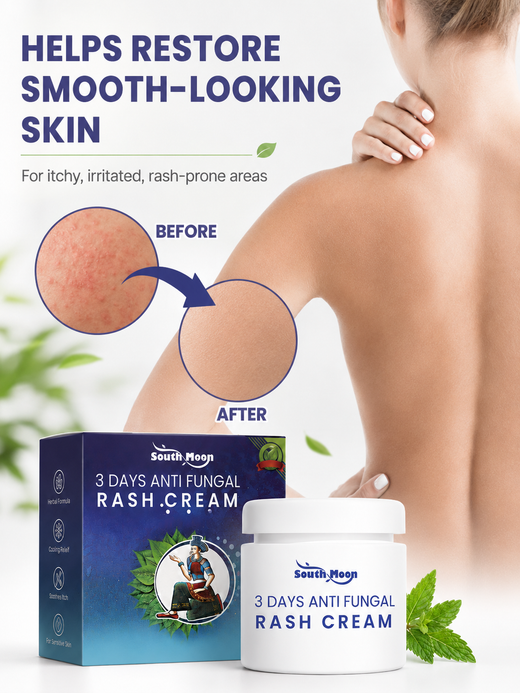 Anti-Fungal Rash Cream – 3-Day Relief & Instant Cooling