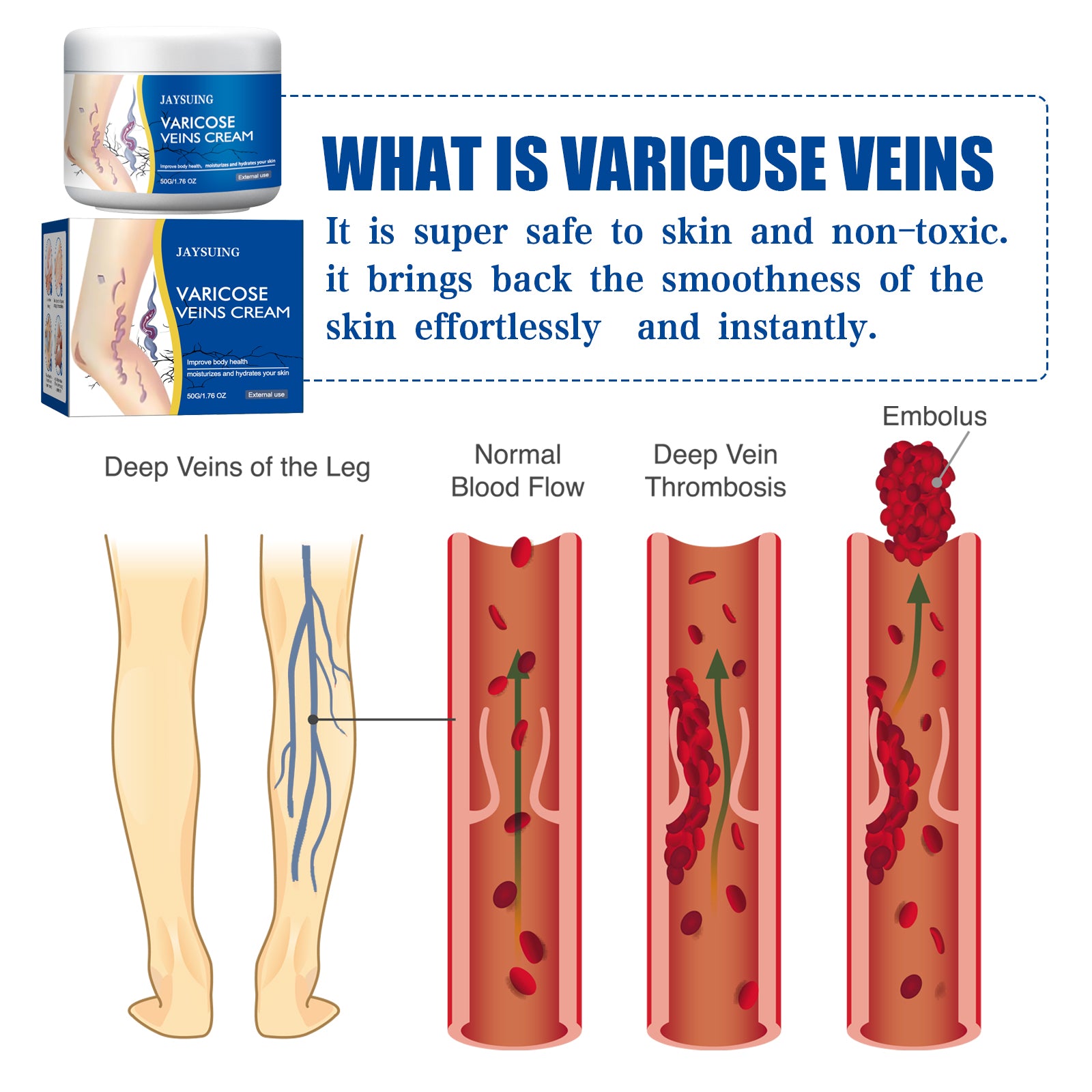 Jaysung Varicose Veins Cream jar and retail box displayed together showing full product packaging design