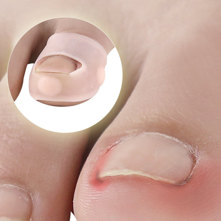 Silicone Ingrown Toenail Corrector — Painless