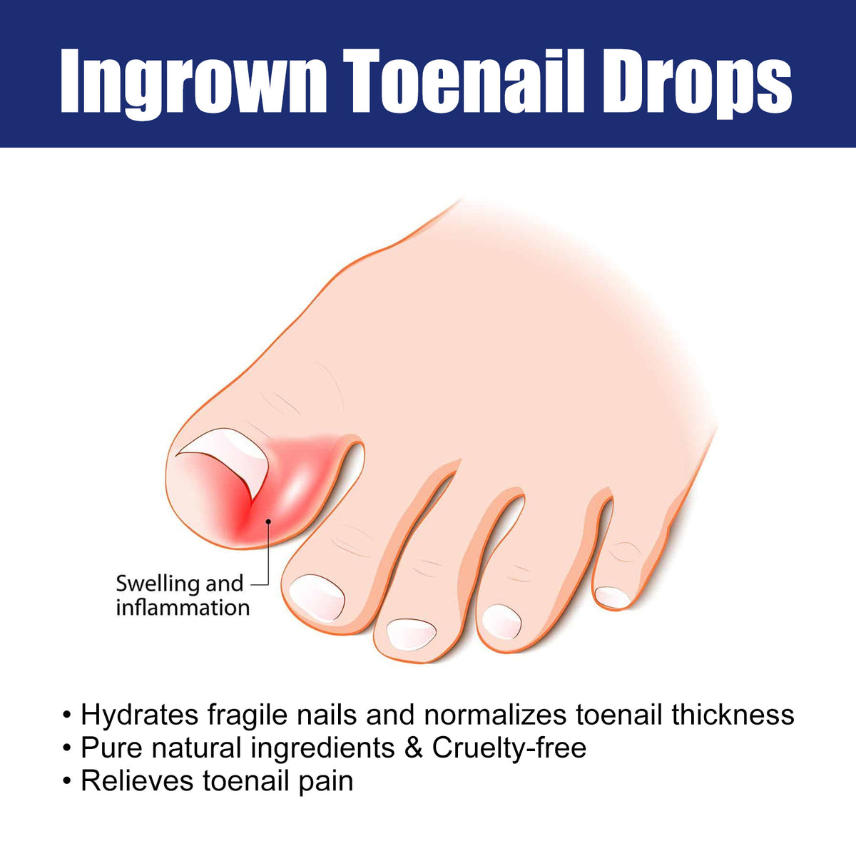 Nail Repair Solution for Gentle Ingrown Toenail Relief