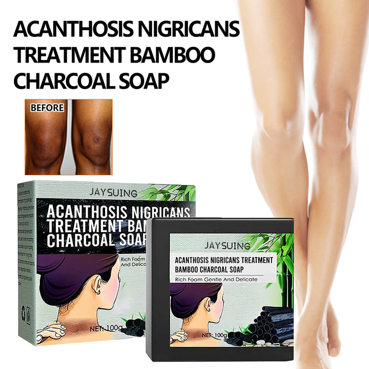 Underarm Whitening Antibacterial Soap – Fades Dark Spots