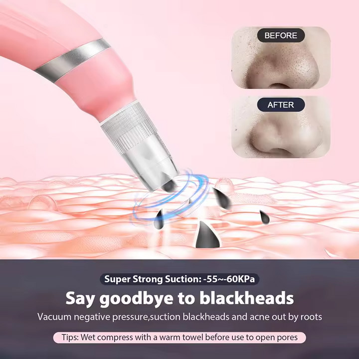 At-Home Microdermabrasion Pore Cleaner — Smooth, Clear Skin
