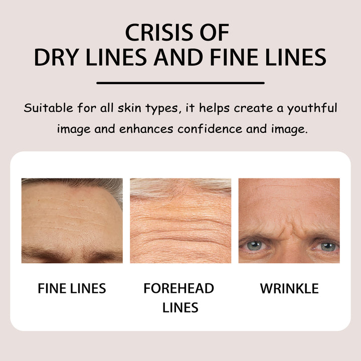 Forehead Mask for Hydration & Smoother-Looking Lines