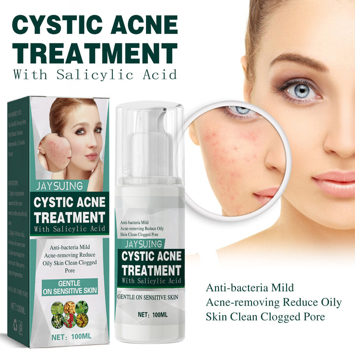 Cystic Acne Cream With Salicylic Acid For Clogged Pores