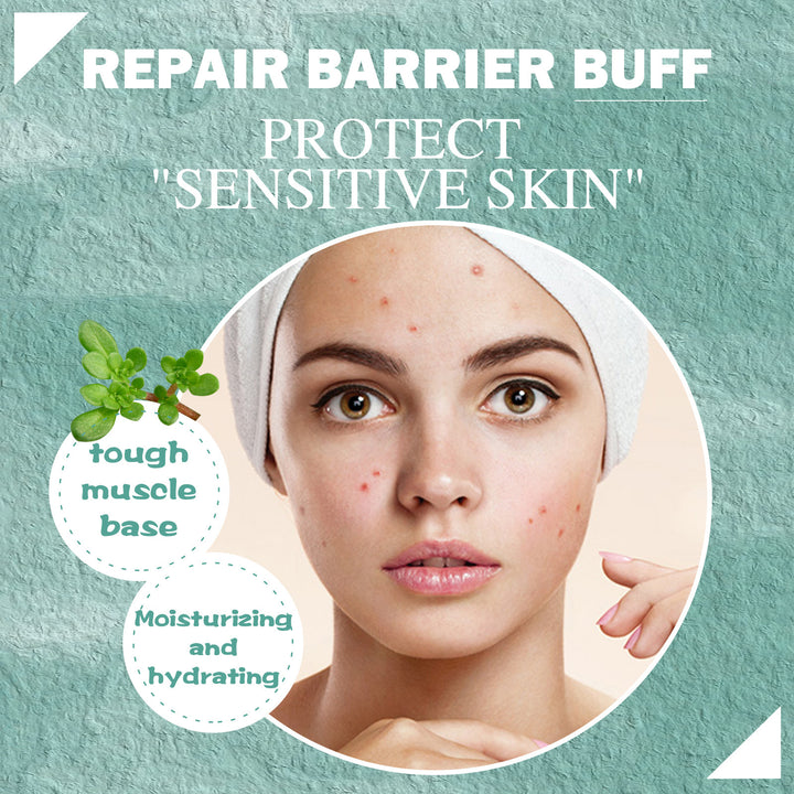 Cystic Acne Cream With Salicylic Acid For Clogged Pores