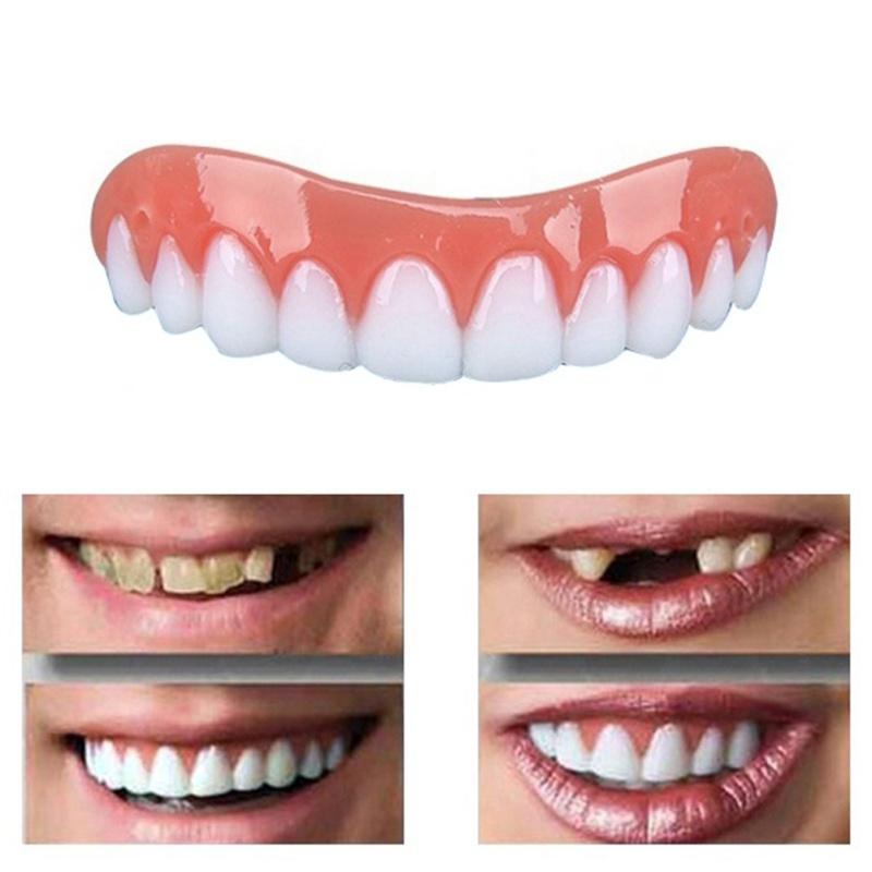 Instant Smile Veneers — Perfect Teeth in Seconds, No Dentist