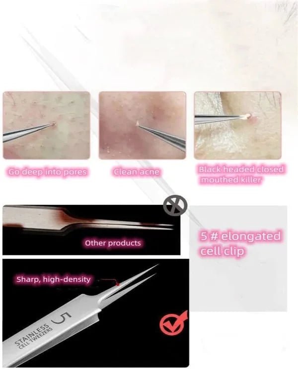 Professional Blackhead Tweezers - wanelo - store - roman