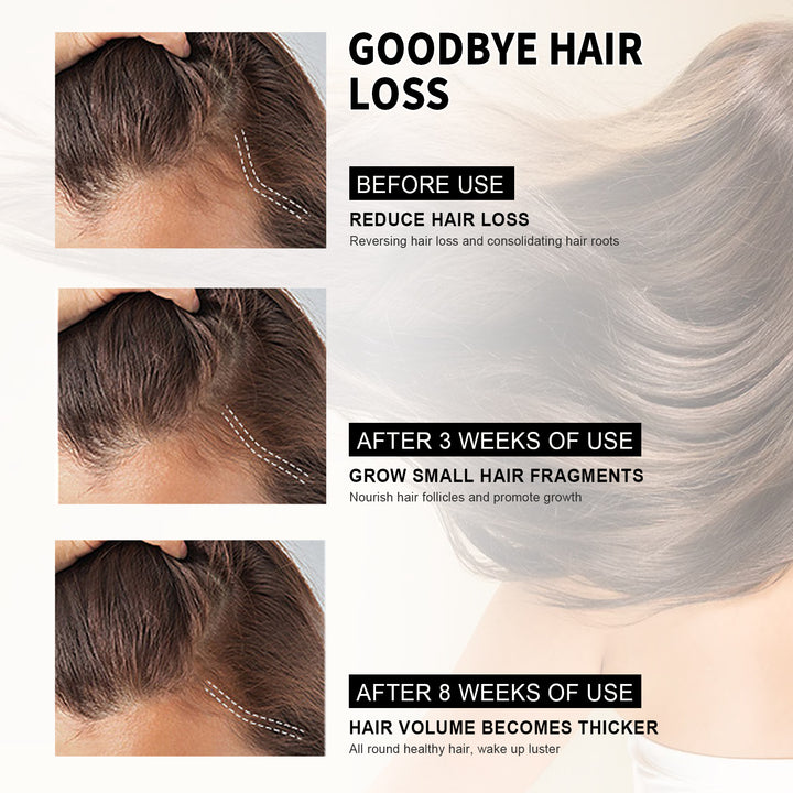 Scalp Oil Serum for Thicker-Looking, Fuller Hair Care