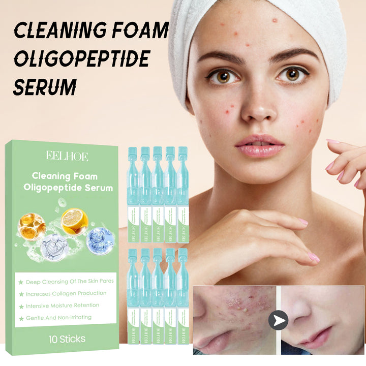 Micro Cleansing Foam Essence – Softens & Brightens Dull Skin