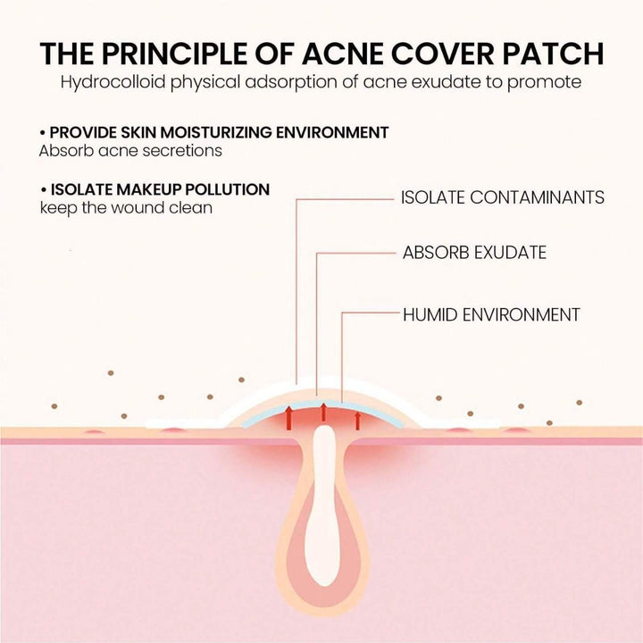 Star & Heart Acne Patches — 200 Fun Hydrocolloid Pimple