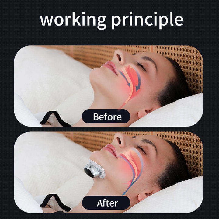 Anti-Snoring Pulse Device — Stop Snoring Naturally, 12g