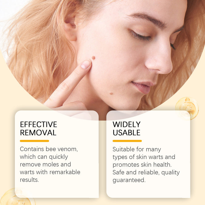 Wart and Skin Tag Cream for Careful At-Home Care