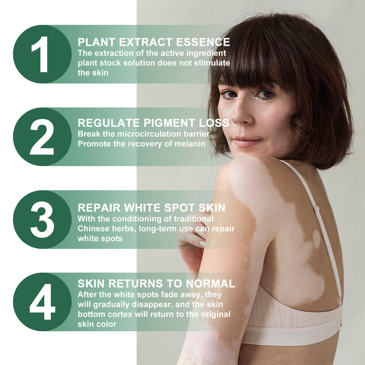 Vitiligo Relief Cream for White Spot Skin Care Routine