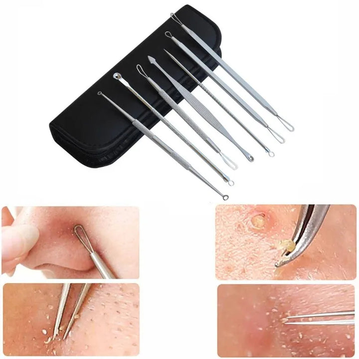 Pimple Extractor Tool — 7‑Piece Precision Acne Removal Set