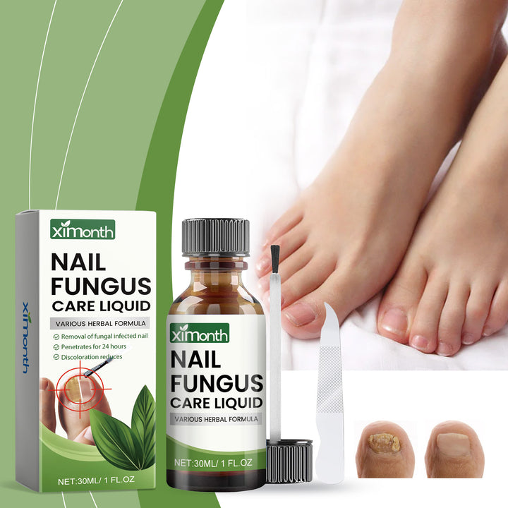 Toenail Fungus Care Set for At-Home Nail Grooming