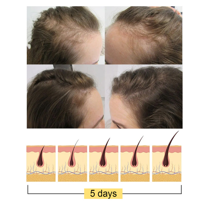 Ginger Shampoo Bar for Fuller-Looking, Stronger Hair