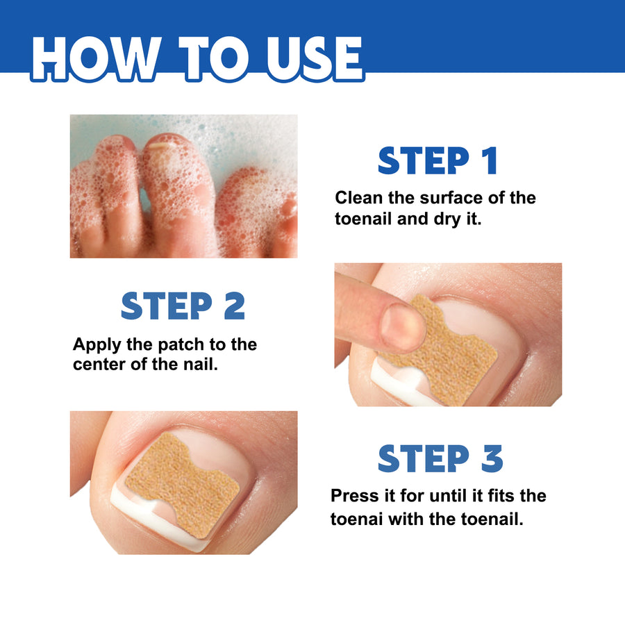Toenail Care Patches for Targeted Nail Comfort at Home