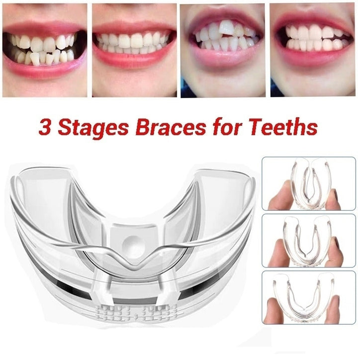 3-Stage Orthodontic Trainer — Straighten Teeth Affordably