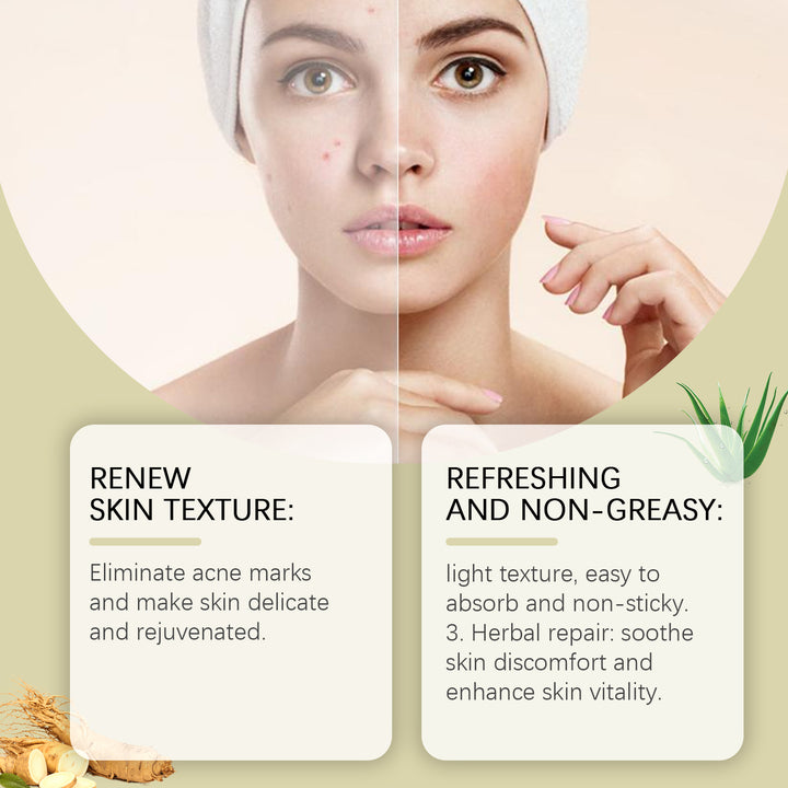 Moisturizing Toner for Acne-Prone Skin — Hydrating & Gentle