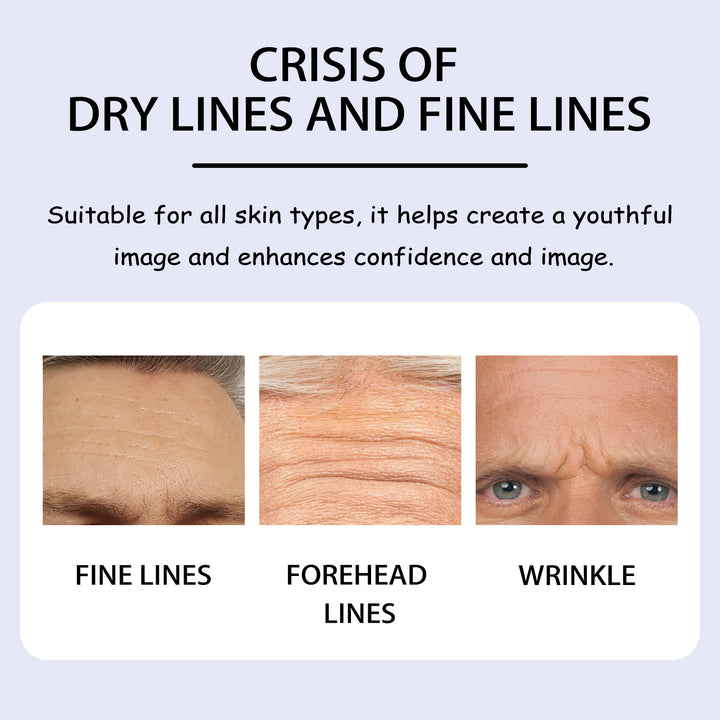 Forehead Patches for Smoother, Hydrated-Looking Skin