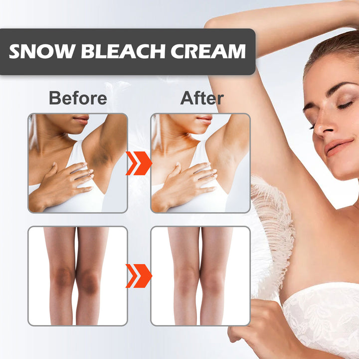 Brightening Cream for Dark Elbows, Knees & Armpits