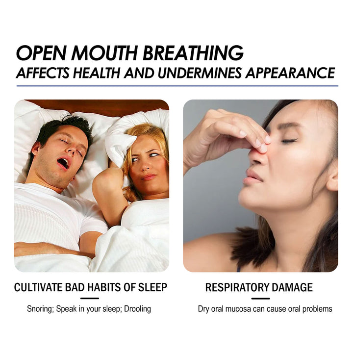 Anti-Snoring Mouthguard for Nighttime Teeth Grinding