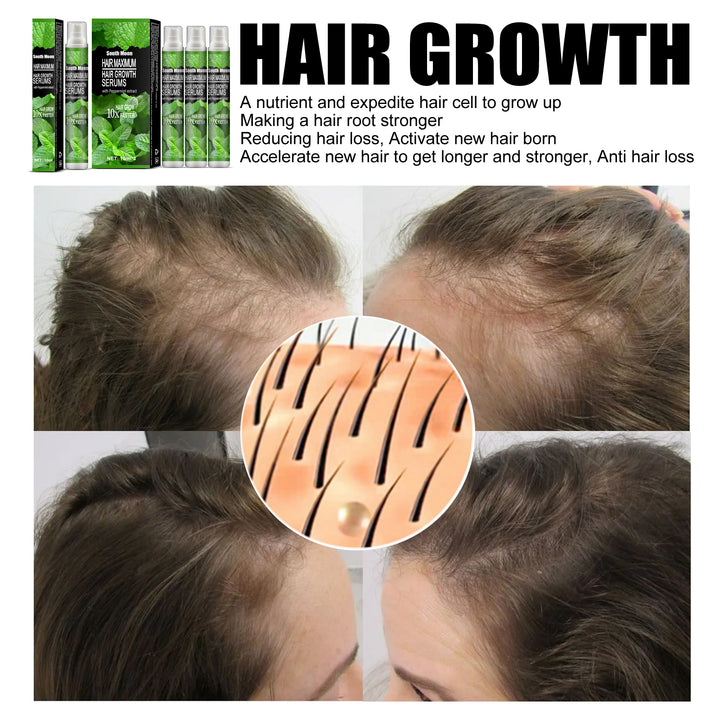 Peppermint Hair Growth Serum for Thinning Hair Care