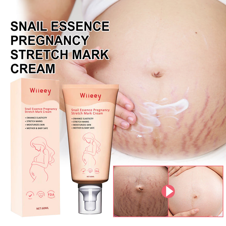Pregnancy Stretch Mark Cream for Elasticity & Moisture