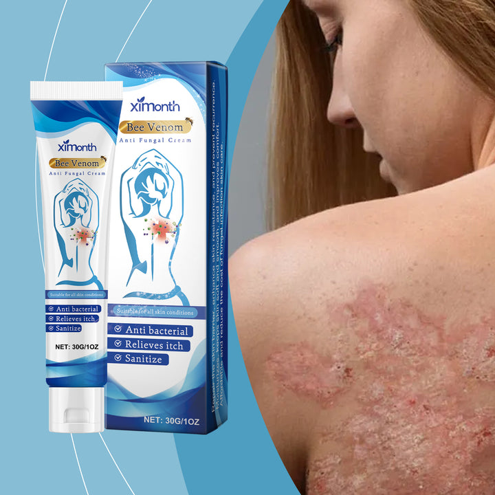 Antifungal Body Cream for Itchy, Irritated Skin Care