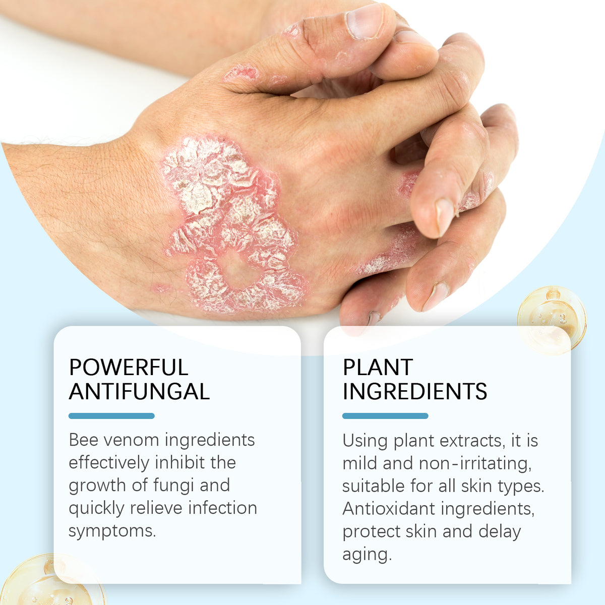 Antifungal Body Cream for Itchy, Irritated Skin Care