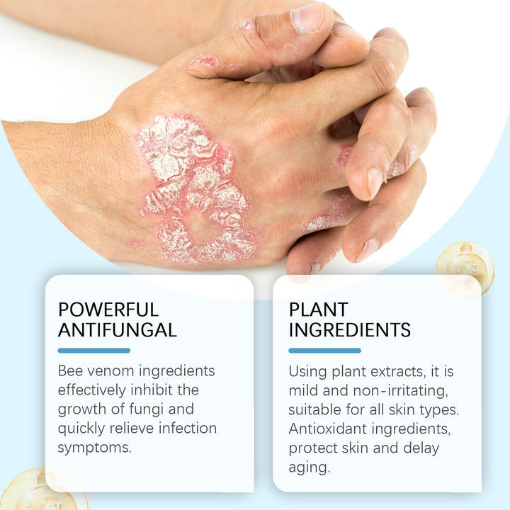 Antifungal Body Cream for Itchy, Irritated Skin Care