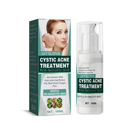 Acne Treatment: Pimple Spot Creams & Topical Solutions for Skin