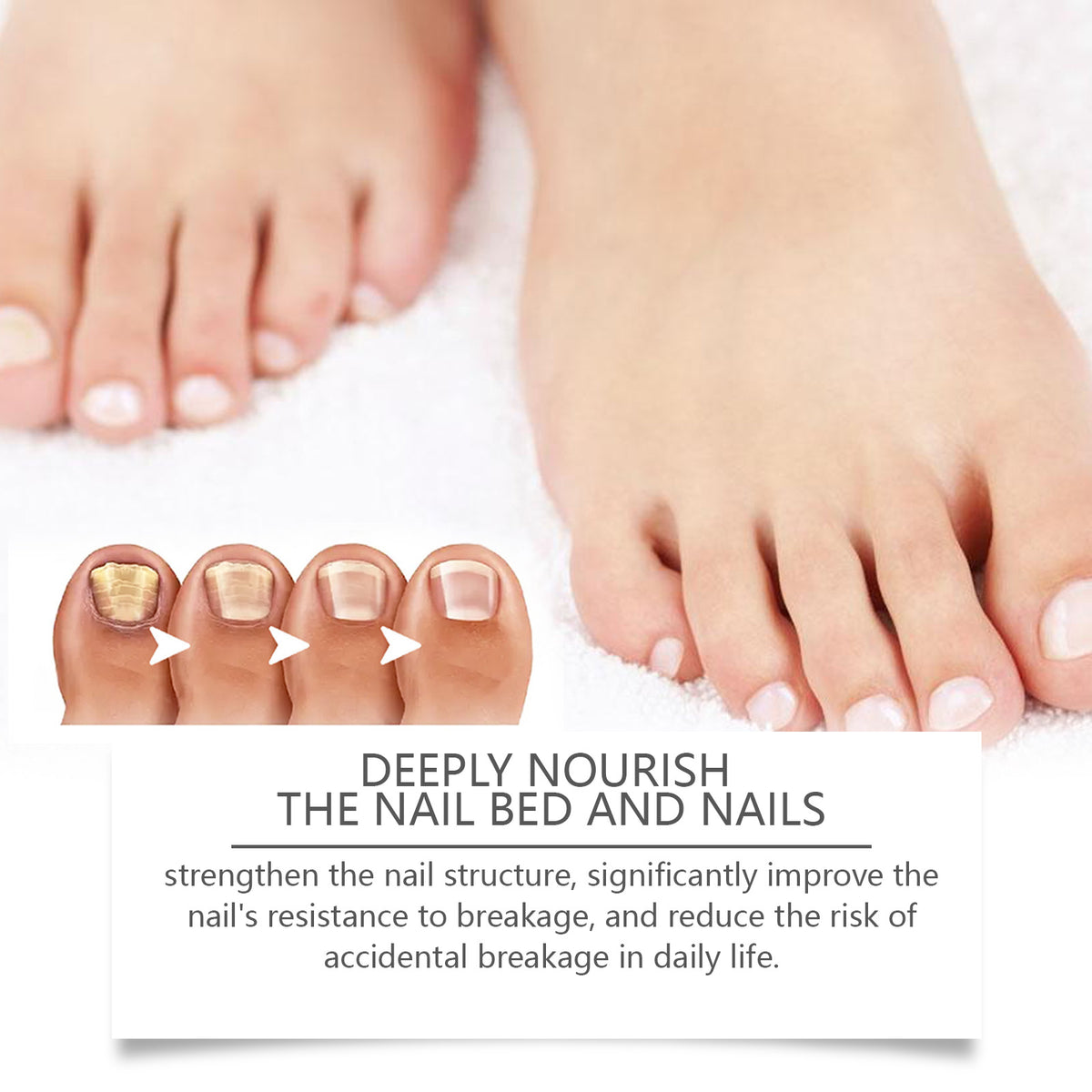 Nail Repair Solution — Gentle Moisturizing & Strengthening