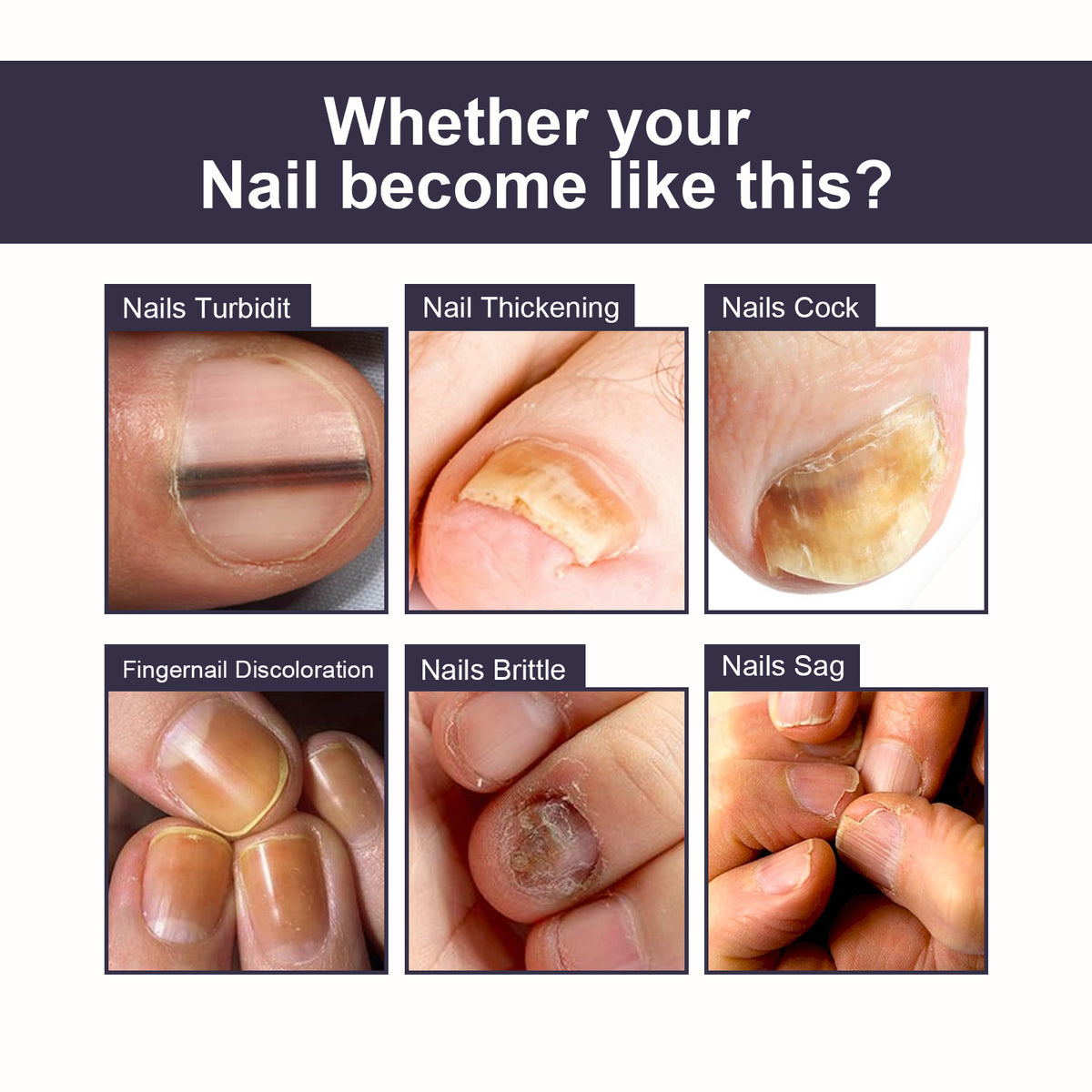 Nail Repair Essence for Smoother, Healthier-Looking Nails