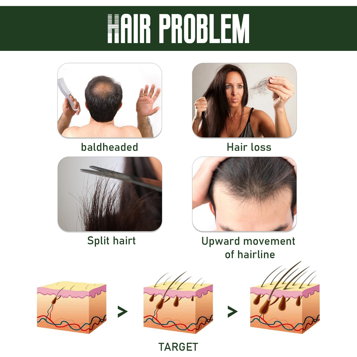 Ginger Hair Spray for Hydrated, Stronger-Looking Hair