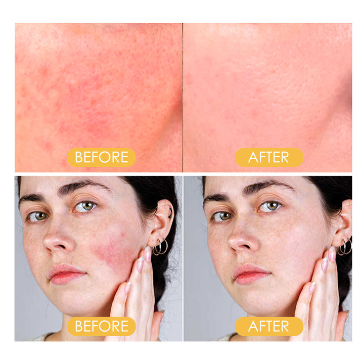 Setting Powder SPF 50+ Matte Oil-Control Touch-Up