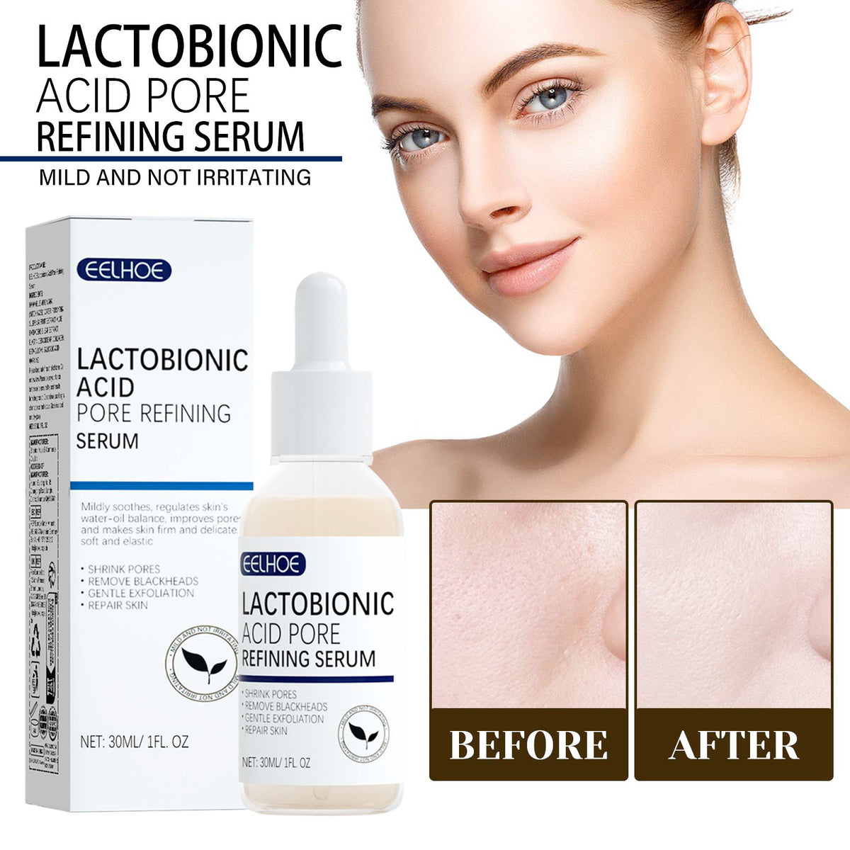 Lactosyl Acid Essence for Pores and Blackhead Control