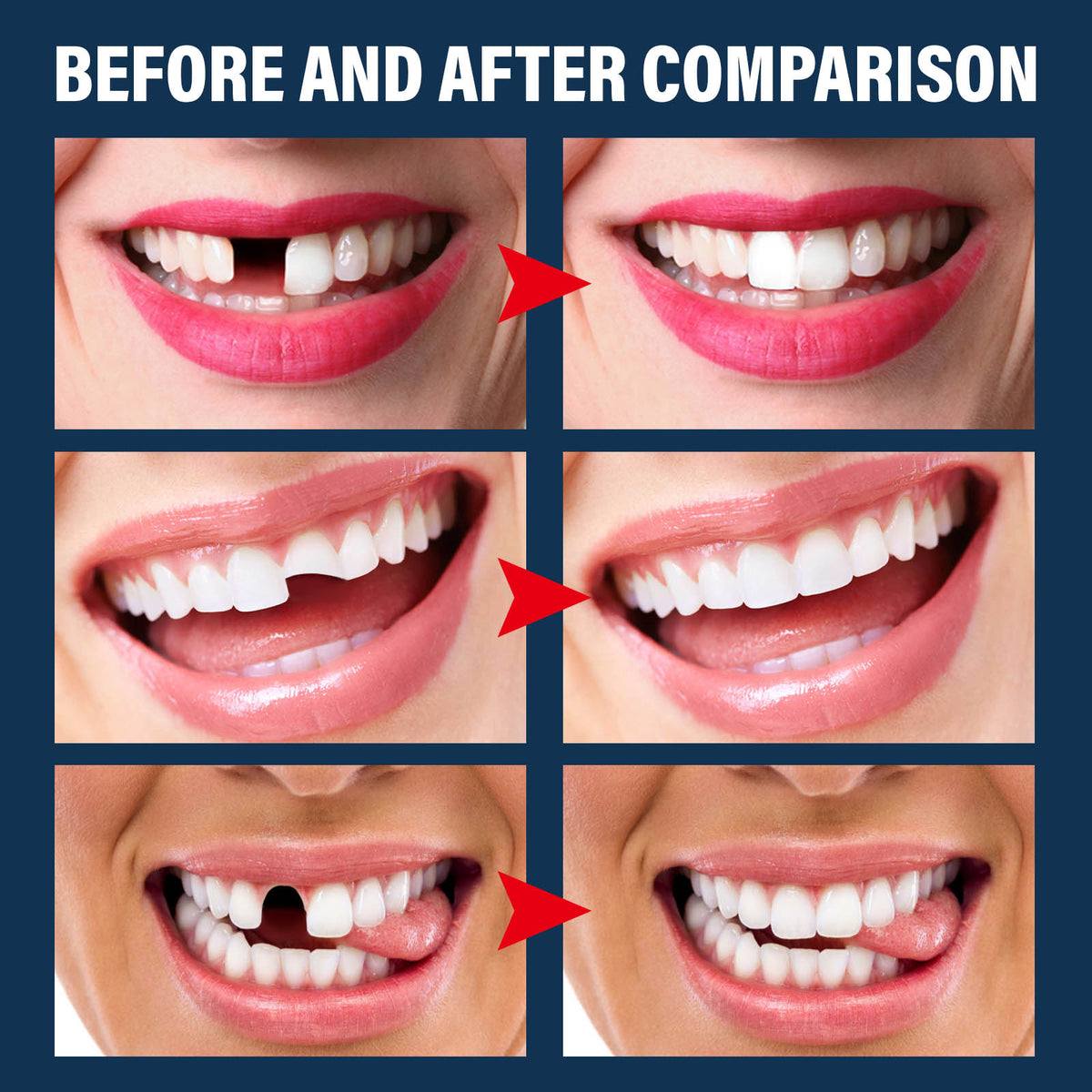 Temporary Tooth Repair Kit for Halloween Costumes & Cosplay