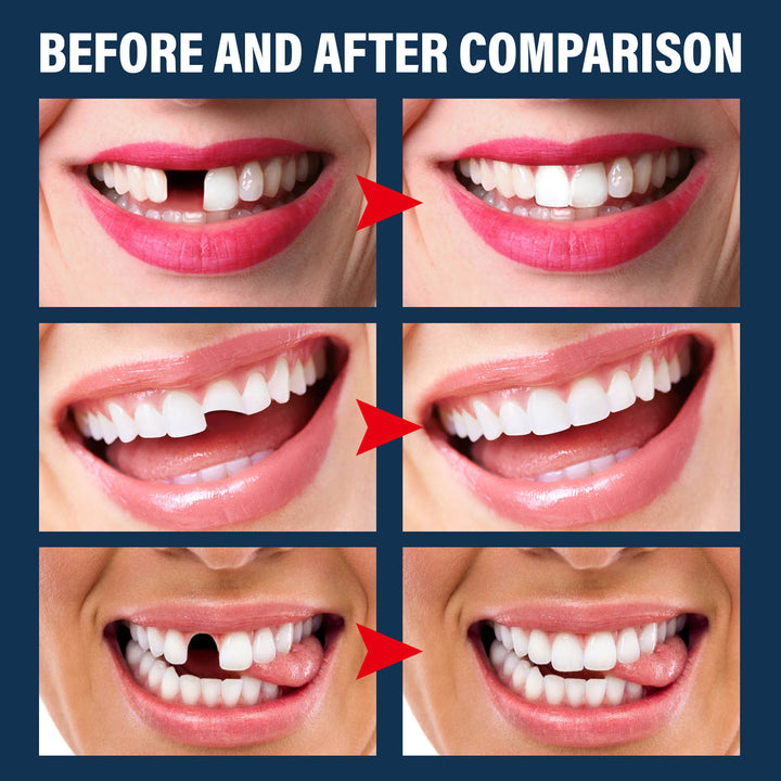 Temporary Tooth Repair Kit for Halloween Costumes & Cosplay