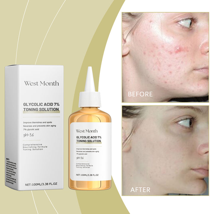 Moisturizing Toner for Acne-Prone Skin — Hydrating & Gentle