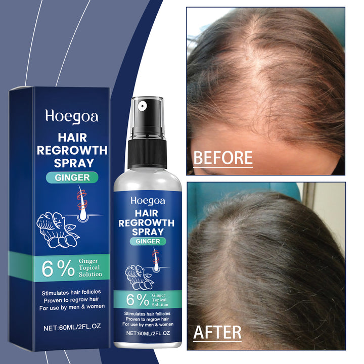 Ginger Hair Regrowth Spray for Thinning, Dry Hair