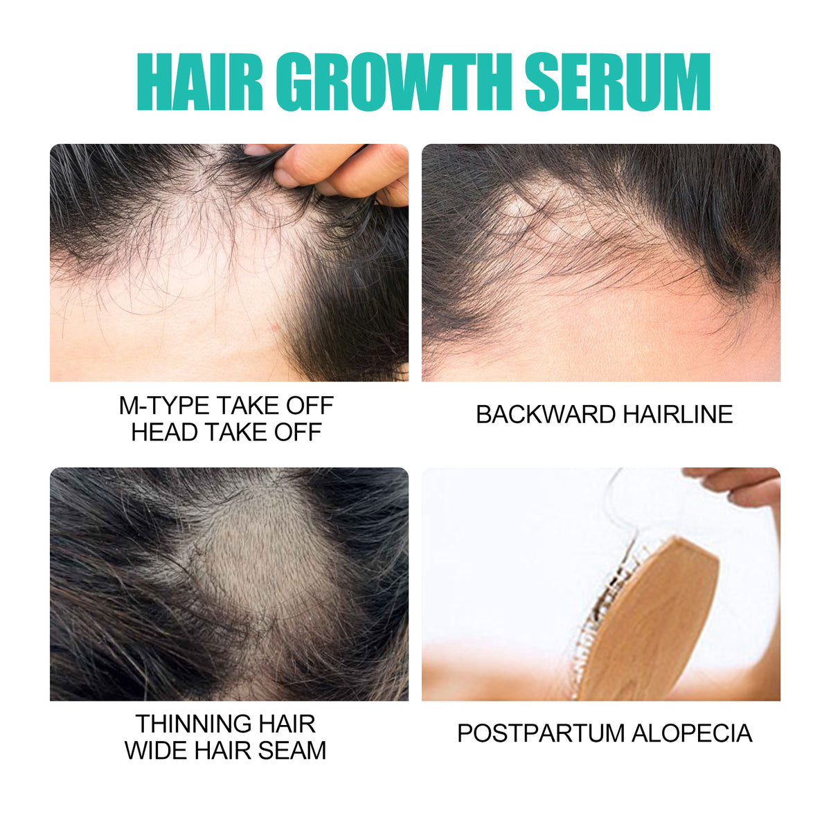 Hair Growth Serum for Fuller, Healthier-Looking Hair