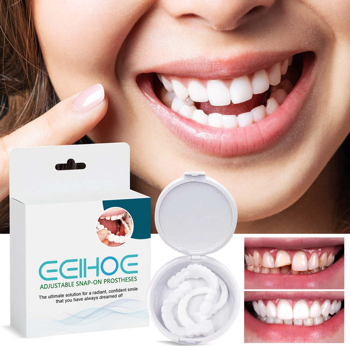 Adjustable Snap-On Dentures for a Confident Smile
